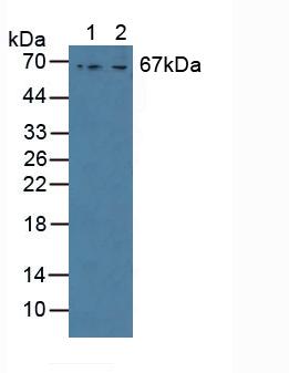 GAB3 Antibody - Western Blot; Sample: Lane1: Human MCF-7 Cells; Lane2: Human HepG2 Cells.