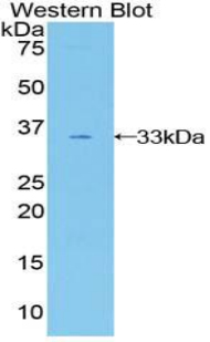GAB3 Antibody - Western blot of recombinant GAB3.  This image was taken for the unconjugated form of this product. Other forms have not been tested.