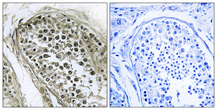 GAB4 Antibody - Immunohistochemistry analysis of paraffin-embedded human tesophagusis, using GAB4 Antibody. The picture on the right is blocked with the synthesized peptide.