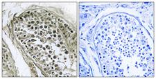 GAB4 Antibody - Peptide - + Immunohistochemistry analysis of paraffin-embedded human testis tissue using GAB4 antibody.
