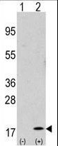 GABARAP Antibody - Western blot of GABARAP (arrow) using purified antibody. 293 cell lysates (2 ug/lane) either nontransfected (Lane 1) or transiently transfected with the GABARAP gene (Lane 2) (Origene Technologies).