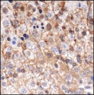 GABARAP Antibody - Immunohistochemistry: GABARAP Antibody - IHC analysis of GABARAP in mouse liver using DAB with hematoxylin counterstain.  This image was taken for the unconjugated form of this product. Other forms have not been tested.