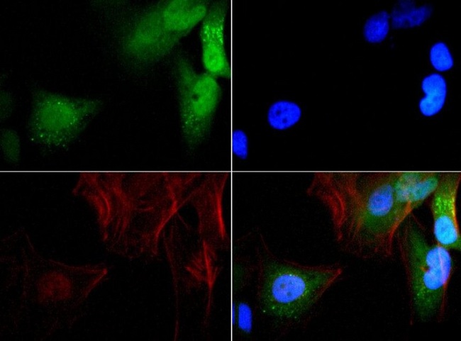 GABARAP Antibody - Immunocytochemistry/Immunofluorescence: GABARAP Antibody - GABARAP antibody was tested in HeLa cells with FITC (green). Nuclei and actin were counterstained with Dapi (blue) and Phalloidin (red).  This image was taken for the unconjugated form of this product. Other forms have not been tested.