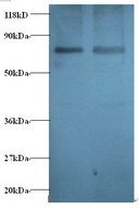 GABARAP Antibody - Western blot of Casein kinase II subunit beta antibody at 2 ug/ml. Lane 1: EC109 whole cell lysate. Lane 2: 293T whole cell lysate. Secondary: Goat polyclonal to Rabbit IgG at 1:15000 dilution. Predicted band size: 13 kDa. Observed band size: 80 kDa.  This image was taken for the unconjugated form of this product. Other forms have not been tested.