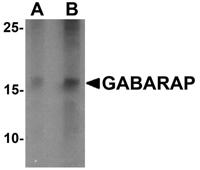 GABARAP Antibody - Western blot analysis of GABARAP in K562 cell lysate with GABARAP antibody at (A) 1 and (B) 2 ug/ml.