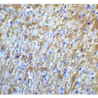 GABARAP Antibody - Immunohistochemistry of GABARAP in mouse brain tissue with GABARAP Antibodyat 5 µg/mL.