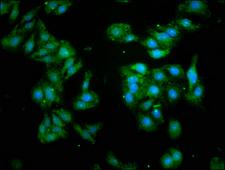 GABARAP Antibody - Immunofluorescence staining of HepG2 cells with GABARAP Antibody at 1:93, counter-stained with DAPI. The cells were fixed in 4% formaldehyde, permeabilized using 0.2% Triton X-100 and blocked in 10% normal Goat Serum. The cells were then incubated with the antibody overnight at 4°C. The secondary antibody was Alexa Fluor 488-congugated AffiniPure Goat Anti-Rabbit IgG(H+L).