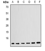 GABARAP Antibody - Western blot analysis of GABARAP expression in HepG2 (A); Jurkat (B); PC12 (C); mouse kidney (D); mouse brain (E); rat kidney (F) whole cell lysates.