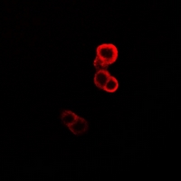 GABARAP Antibody - Immunofluorescent analysis of GABARAP staining in MCF7 cells. Formalin-fixed cells were permeabilized with 0.1% Triton X-100 in TBS for 5-10 minutes and blocked with 3% BSA-PBS for 30 minutes at room temperature. Cells were probed with the primary antibody in 3% BSA-PBS and incubated overnight at 4 deg C in a humidified chamber. Cells were washed with PBST and incubated with a DyLight 594-conjugated secondary antibody (red) in PBS at room temperature in the dark.