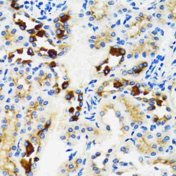 GABARAP Antibody - Immunohistochemistry of paraffin-embedded rat kidney using GABARAP antibody at dilution of 1:100 (40x lens).