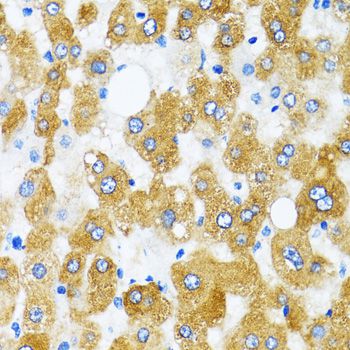 GABARAP Antibody - Immunohistochemistry of paraffin-embedded human liver using GABARAP antibody at dilution of 1:100 (40x lens).