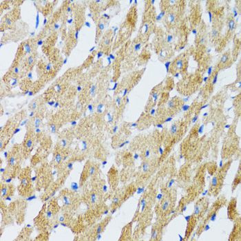 GABARAP Antibody - Immunohistochemistry of paraffin-embedded mouse heart using GABARAP antibody at dilution of 1:100 (40x lens).