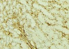 GABARAP Antibody - 1:100 staining mouse kidney tissue by IHC-P. The sample was formaldehyde fixed and a heat mediated antigen retrieval step in citrate buffer was performed. The sample was then blocked and incubated with the antibody for 1.5 hours at 22°C. An HRP conjugated goat anti-rabbit antibody was used as the secondary.