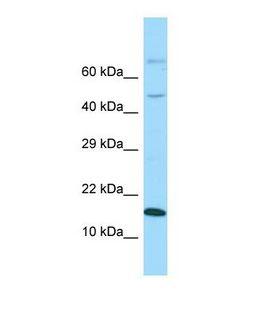 GABARAPL1 / ATG8 Antibody - Western blot of Human Fetal Brain. GABARAPL1 antibody dilution 1.0 ug/ml.  This image was taken for the unconjugated form of this product. Other forms have not been tested.
