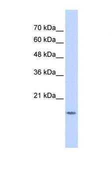 GABARAPL1 / ATG8 Antibody - GABARAPL1 antibody Western blot of 293T Cell lysate. Antibody concentration 1 ug/ml. This image was taken for the unconjugated form of this product. Other forms have not been tested.