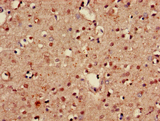 GABARAPL1 / ATG8 Antibody - Immunohistochemistry of paraffin-embedded human brain tissue using GABARAPL1 Antibody at dilution of 1:100