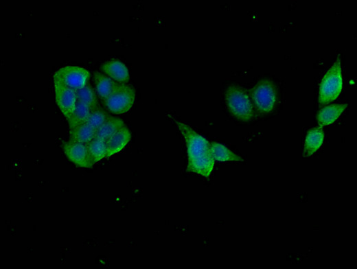 GABARAPL1 / ATG8 Antibody - Immunofluorescent analysis of PC3 cells using GABARAPL1 Antibody at a dilution of 1:100 and Alexa Fluor 488-congugated AffiniPure Goat Anti-Rabbit IgG(H+L)