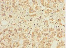 GABARAPL1 / ATG8 Antibody - Immunohistochemistry of paraffin-embedded human adrenal gland tissue at dilution 1:100