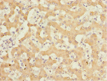 GABARAPL1 / ATG8 Antibody - Immunohistochemistry of paraffin-embedded human liver tissue at dilution 1:100