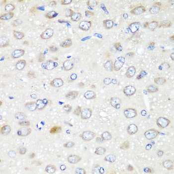 GABARAPL2 / ATG8 Antibody - Immunohistochemistry of paraffin-embedded rat brain tissue.