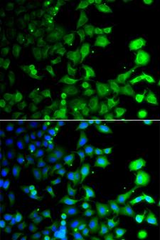 GABARAPL2 / ATG8 Antibody - Immunofluorescence analysis of A549 cells.