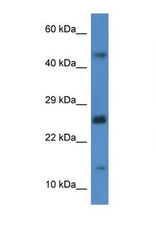 GABARAPL2 / ATG8 Antibody - GABARAPL2 antibody Western blot of Rat Brain lysate. Antibody concentration 1 ug/ml. This image was taken for the unconjugated form of this product. Other forms have not been tested.