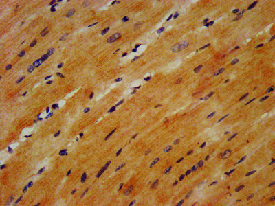 GABARAPL2 / ATG8 Antibody - IHC image of GABARAPL2 Antibody diluted at 1:1200 and staining in paraffin-embedded human heart tissue performed on a Leica BondTM system. After dewaxing and hydration, antigen retrieval was mediated by high pressure in a citrate buffer (pH 6.0). Section was blocked with 10% normal goat serum 30min at RT. Then primary antibody (1% BSA) was incubated at 4°C overnight. The primary is detected by a biotinylated secondary antibody and visualized using an HRP conjugated SP system.