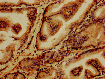 GABARAPL2 / ATG8 Antibody - IHC image of GABARAPL2 Antibody diluted at 1:1200 and staining in paraffin-embedded human prostate tissue performed on a Leica BondTM system. After dewaxing and hydration, antigen retrieval was mediated by high pressure in a citrate buffer (pH 6.0). Section was blocked with 10% normal goat serum 30min at RT. Then primary antibody (1% BSA) was incubated at 4°C overnight. The primary is detected by a biotinylated secondary antibody and visualized using an HRP conjugated SP system.