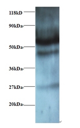 GABARAPL2 / ATG8 Antibody - Western blot of Gamma-aminobutyric acid receptor-associated protein-like 2 antibody at 2 ug/ml + EC109whole cell lysate. Secondary: Goat polyclonal to Rabbit IgG at 1:15000 dilution. Predicted band size: 13 kDa. Observed band size: 60 kDa.  This image was taken for the unconjugated form of this product. Other forms have not been tested.