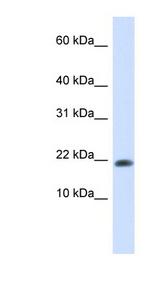GABARAPL2 / ATG8 Antibody - GABARAPL2 antibody Western blot of 293T cell lysate. This image was taken for the unconjugated form of this product. Other forms have not been tested.