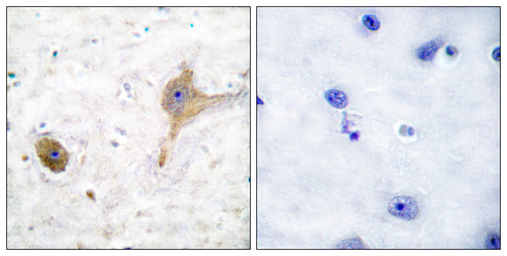GABBR1 / GABA B Receptor 1 Antibody - Immunohistochemistry analysis of paraffin-embedded human brain tissue, using GABA-B Receptor Antibody. The picture on the right is blocked with the synthesized peptide.