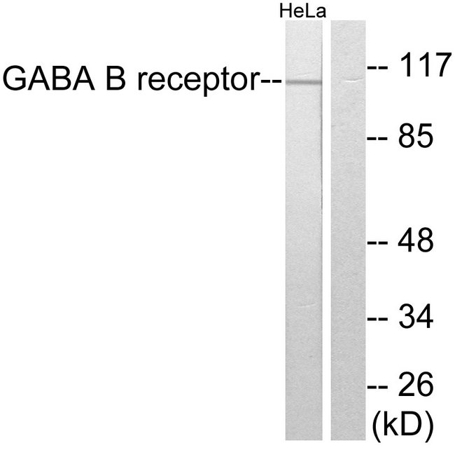 GABBR1 / GABA B Receptor 1 Antibody - Western blot analysis of lysates from HeLa cells, using GABA-B Receptor Antibody. The lane on the right is blocked with the synthesized peptide.