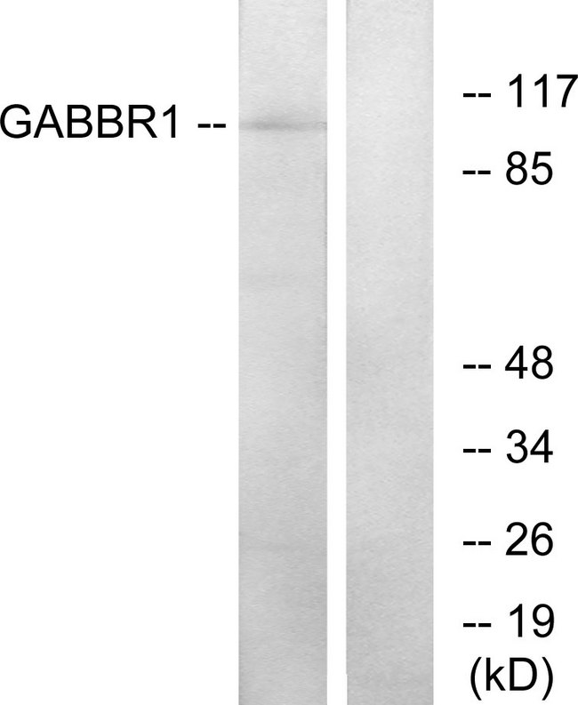 GABBR1 / GABA B Receptor 1 Antibody - Western blot analysis of lysates from K562 cells, using GABBR1 Antibody. The lane on the right is blocked with the synthesized peptide.