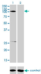 GABBR1 / GABA B Receptor 1 Antibody - Western blot analysis of GABBR1 over-expressed 293 cell line, cotransfected with GABBR1 Validated Chimera RNAi (Lane 2) or non-transfected control (Lane 1). Blot probed with GABBR1 monoclonal antibody (M01), clone 2D7 . GAPDH ( 36.1 kDa ) used as specificity and loading control.