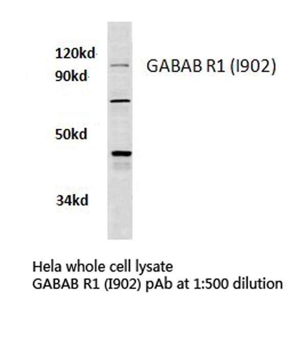 GABBR1 / GABA B Receptor 1 Antibody - Western blot of GABA-B Receptor (I902) pAb in extracts HeLa cells.