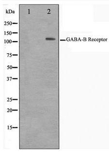 GABBR1 / GABA B Receptor 1 Antibody - Western blot of HeLa cell lysate using GABBR1 Antibody