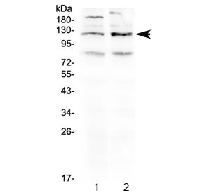 GABBR1 / GABA B Receptor 1 Antibody - Western blot testing of 1) rat brain and 2) mouse brain lysate using GABA B Receptor 1 antibody at 0.5ug/ml. Predicted molecular weight: 108-130 kDa (multiple isoforms).