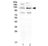 GABBR1 / GABA B Receptor 1 Antibody - Western blot testing of 1) rat brain and 2) mouse brain lysate using GABA B Receptor 1 antibody at 0.5ug/ml. Predicted molecular weight: 108-130 kDa (multiple isoforms).