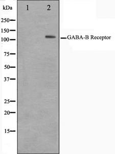 GABBR1 / GABA B Receptor 1 Antibody - Western blot analysis on HeLa cell lysates using GABBR1 antibody. The lane on the left is treated with the antigen-specific peptide.
