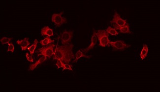 GABBR1 / GABA B Receptor 1 Antibody - Staining HeLa cells by IF/ICC. The samples were fixed with PFA and permeabilized in 0.1% Triton X-100, then blocked in 10% serum for 45 min at 25°C. The primary antibody was diluted at 1:200 and incubated with the sample for 1 hour at 37°C. An Alexa Fluor 594 conjugated goat anti-rabbit IgG (H+L) Ab, diluted at 1/600, was used as the secondary antibody.