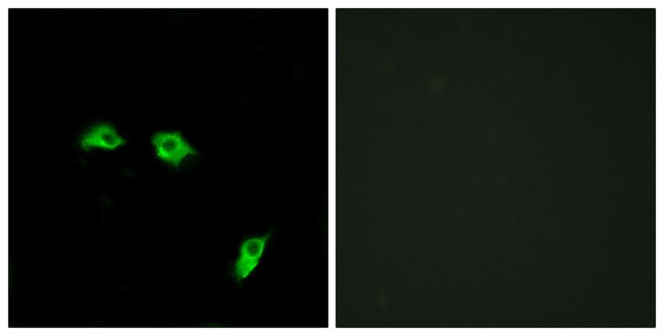 GABBR1 / GABA B Receptor 1 Antibody - Peptide - + Immunofluorescence analysis of HeLa cells, using GABBR1 antibody.