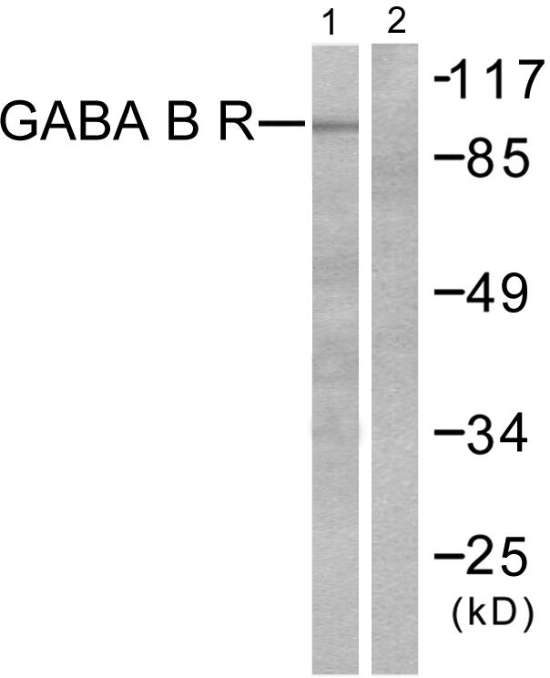 GABBR1 / GABA B Receptor 1 Antibody - Western blot analysis of extracts from HeLa cells, using GABA B Receptor antibody.