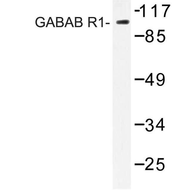 GABBR1 / GABA B Receptor 1 Antibody - Western blot of GABAB R1 (P931) pAb in extracts from K562 cells.
