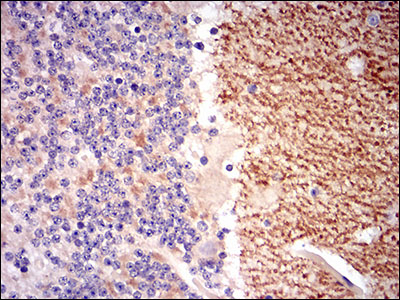 GABBR2 / GABA B Receptor 2 Antibody - IHC of paraffin-embedded cerebellum tissues using GABBR2 mouse monoclonal antibody with DAB staining.