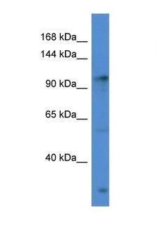 GABBR2 / GABA B Receptor 2 Antibody - GABBR2 antibody Western blot of HeLa Cell lysate. Antibody concentration 1 ug/ml.  This image was taken for the unconjugated form of this product. Other forms have not been tested.