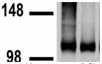GABBR2 / GABA B Receptor 2 Antibody - Immunoblot on mouse (left) and rat (right) brain membranes.