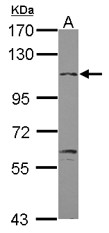 GABBR2 / GABA B Receptor 2 Antibody - Sample (30 ug of whole cell lysate) A: U87-MG 7.5% SDS PAGE GABBR2 antibody diluted at 1:1000
