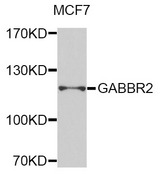 GABBR2 / GABA B Receptor 2 Antibody - Western blot analysis of extracts of MCE7 cells.