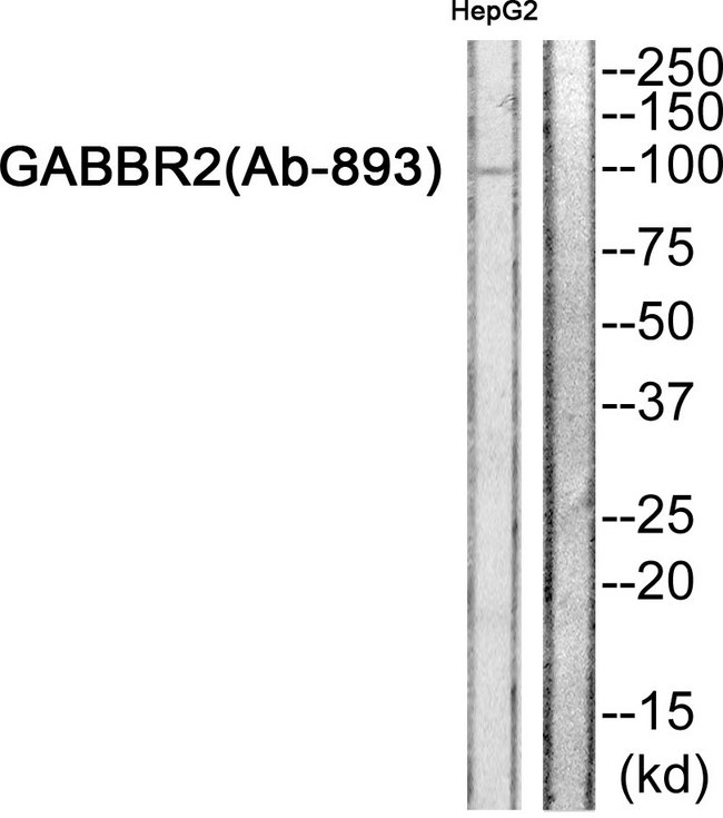 GABBR2 / GABA B Receptor 2 Antibody - Western blot of extracts from HepG2 cells, using GABBR2 (Ab-893) Antibody.
