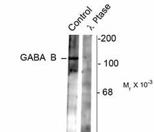 GABBR2 / GABA B Receptor 2 Antibody - Western blot of rat synaptic membrane showing specific immunolabeling of the ~102 k GABAB R2 protein phosphorylated at Ser783 (control). The phosphospecificity of this labeling is shown in the second lane (lambda-phosphatase: lambda phosphatase). The blot